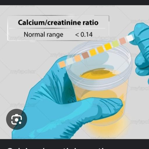 urine calcium creatinine ratio