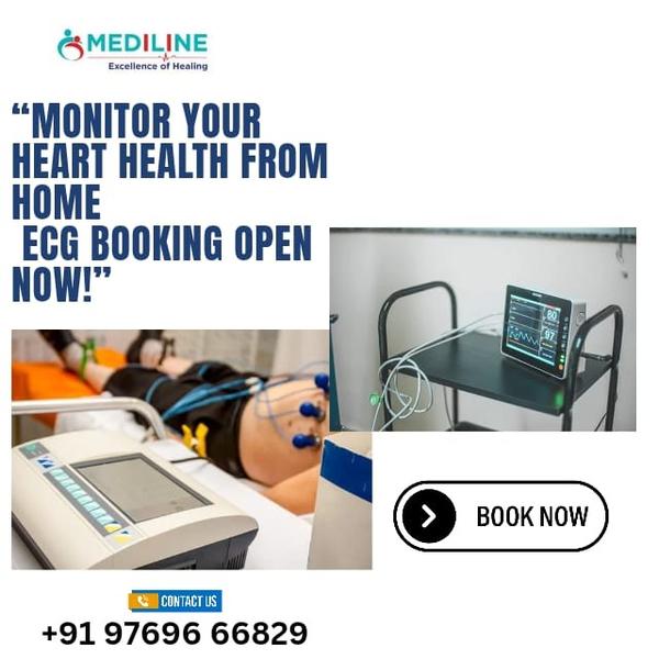 quick ecg service at home