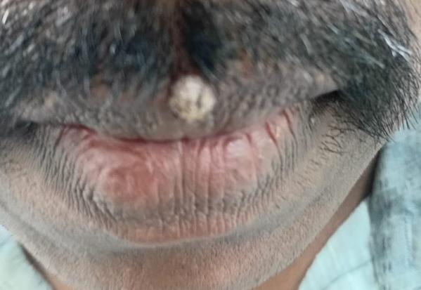 dermatologist doctor in trichy