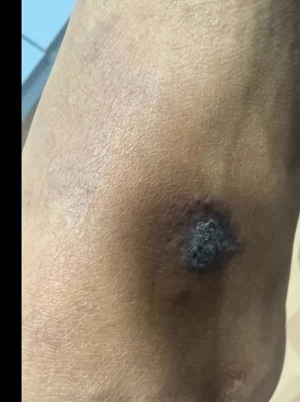 skin diseases doctor thillai n