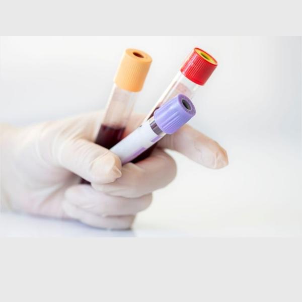 blood culture test in rohini d