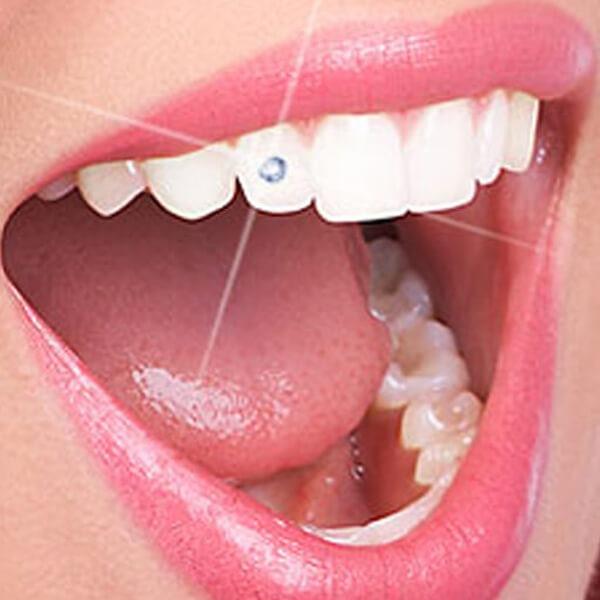 ✨ Add a sparkle to your smile 