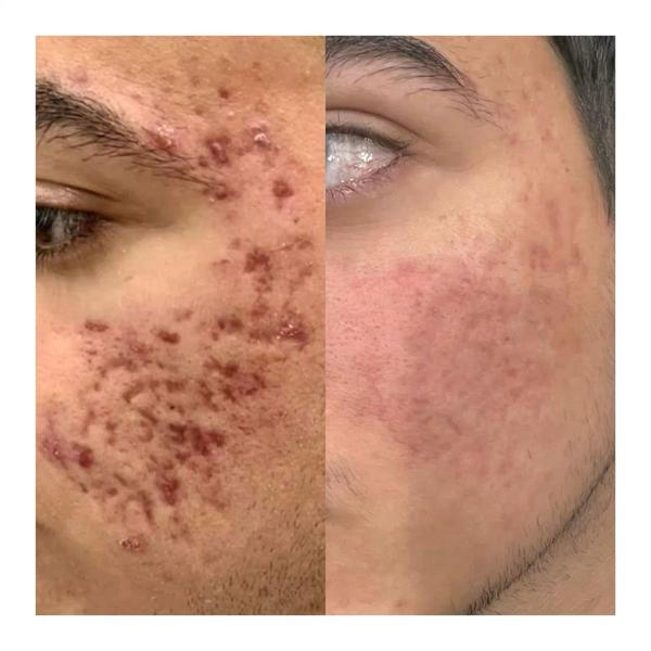 update image