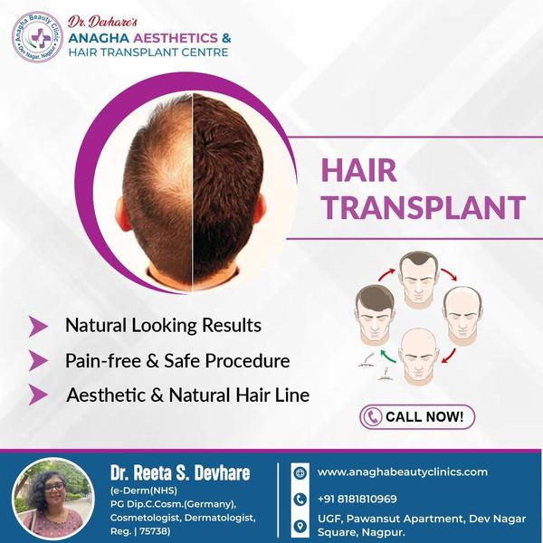 * *Hair Transplant Treatment** Hair tran
