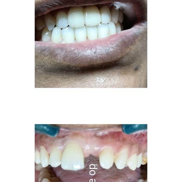 update image