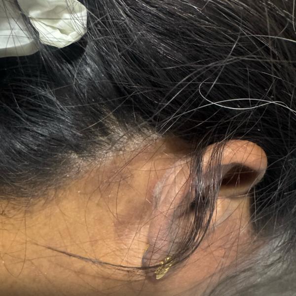 skin doctor trichy fungal infe