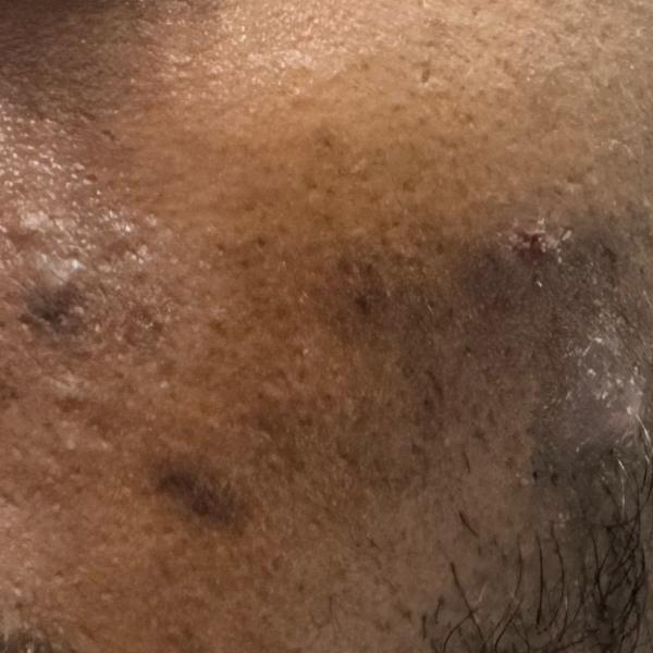 top skin doctor in trichy