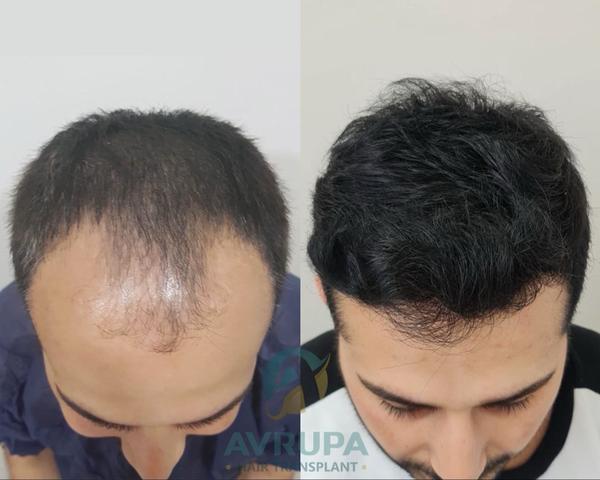 update image