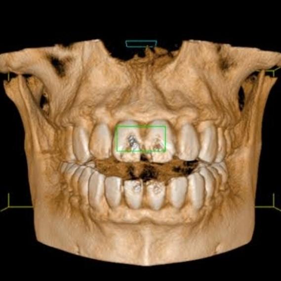 path lab facilities in pitampu