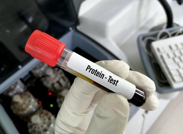 kidney function blood test