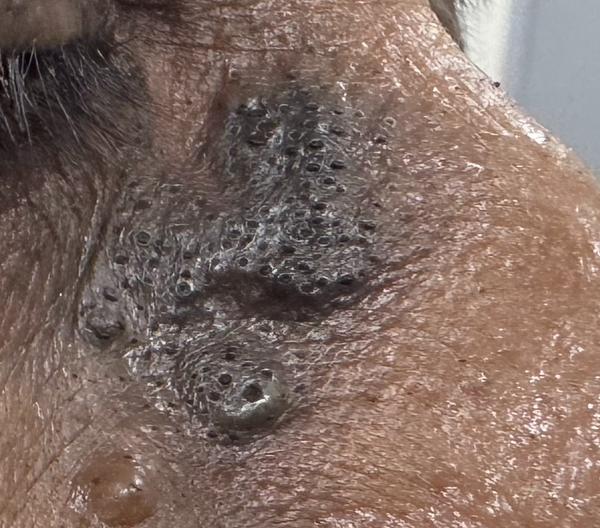 skin disease treatment in tric