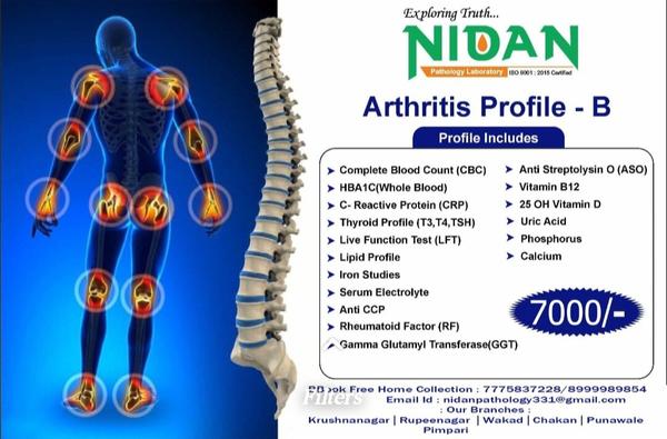 autoimmune disease diagnostic 