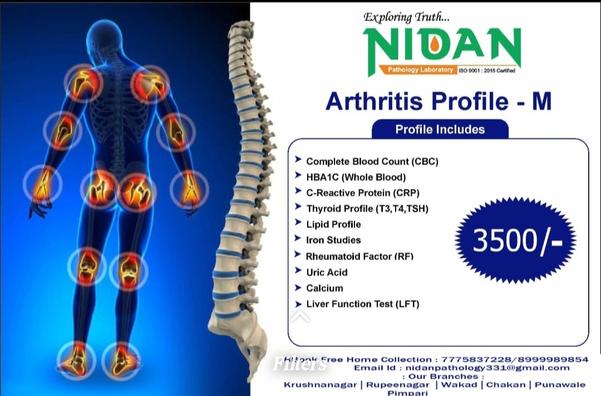 autoimmune disease diagnostic 