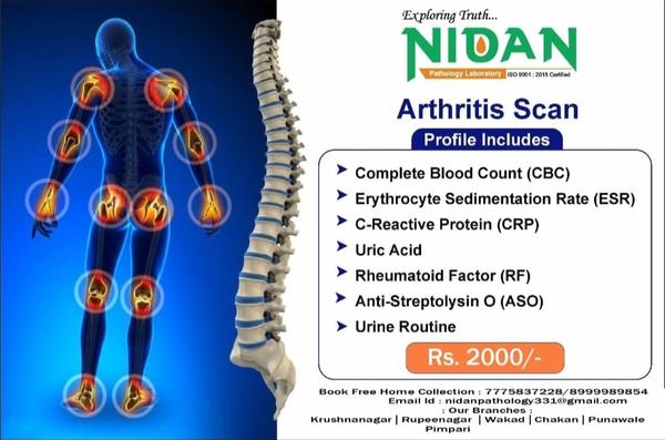 autoimmune disease diagnostic 
