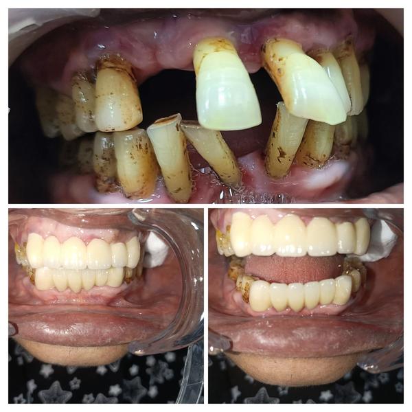 update image