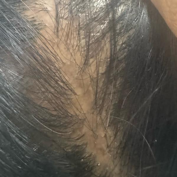 nearby dermatologist for pimpl