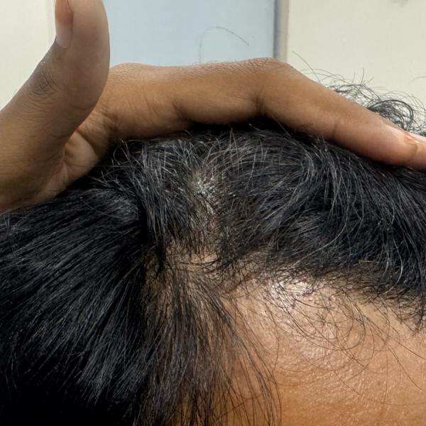 dermatologist doctor in trichy