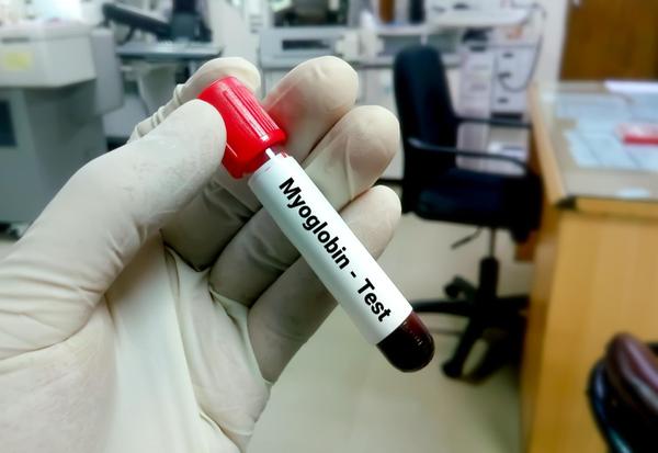 detect early kidney damage