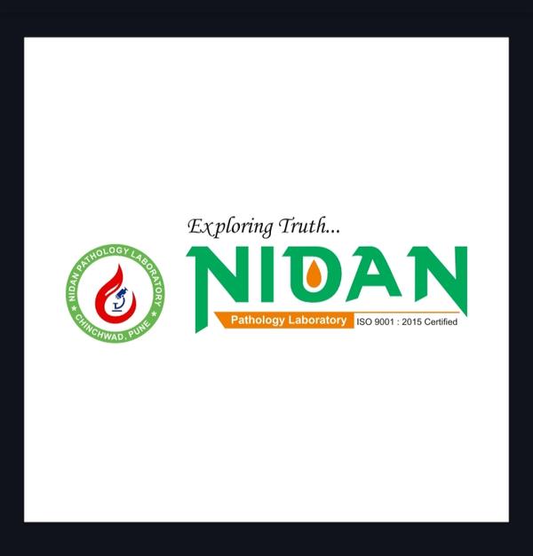 latent tb testing services cha