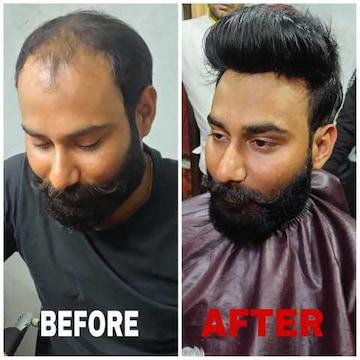 Best hair quality patch in Roh