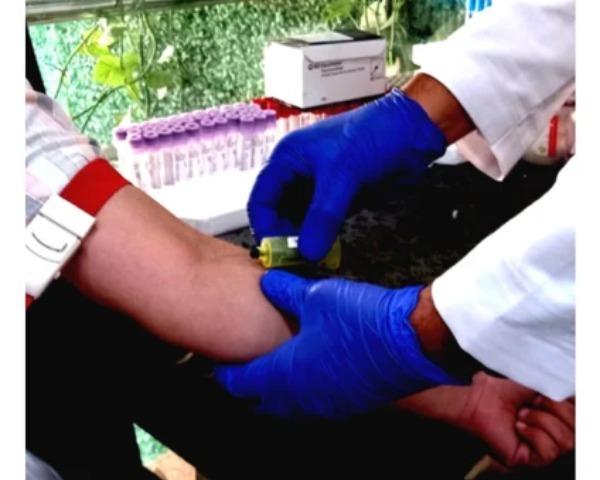 adenovirus igg antibody test d