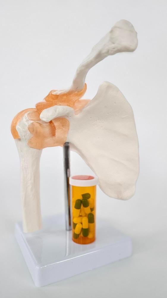 Avascular Necrosis (AVN) is a serious co