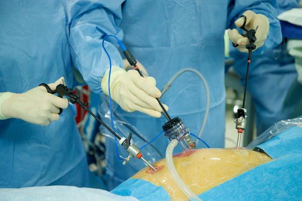 faster recovery after gallblad