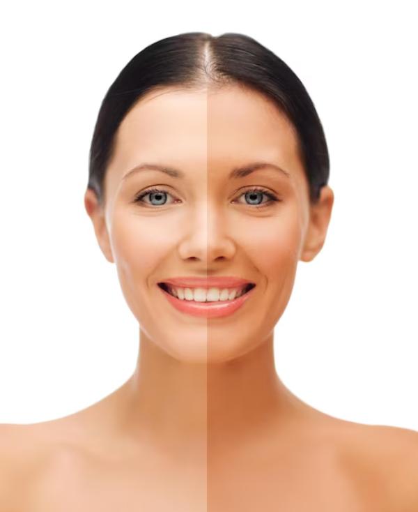 Achieving radiant, even-toned 