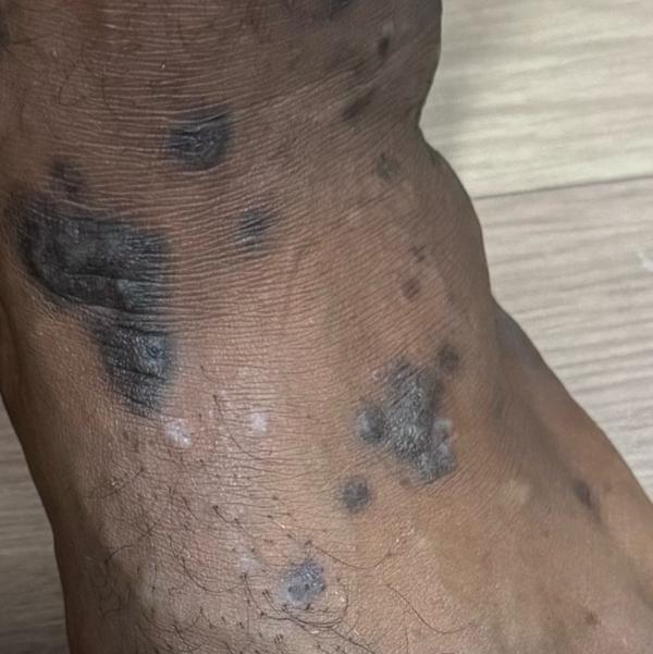 skin disease diagnosis and tre