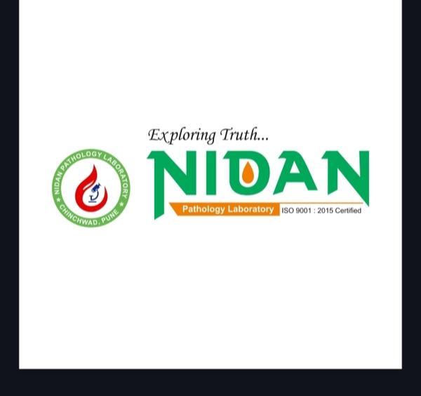 urine alcohol detection test m