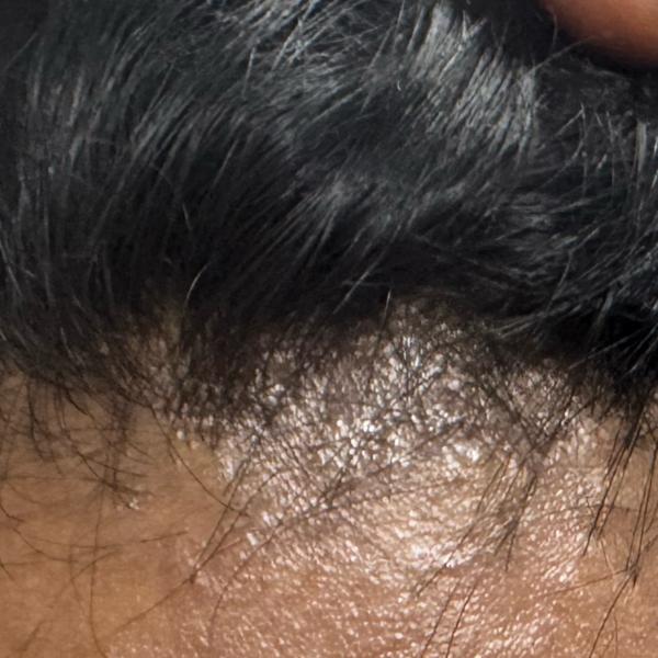 dermatology clinics near me in