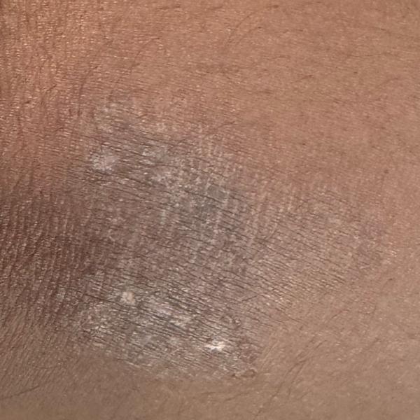 experienced dermatologist for