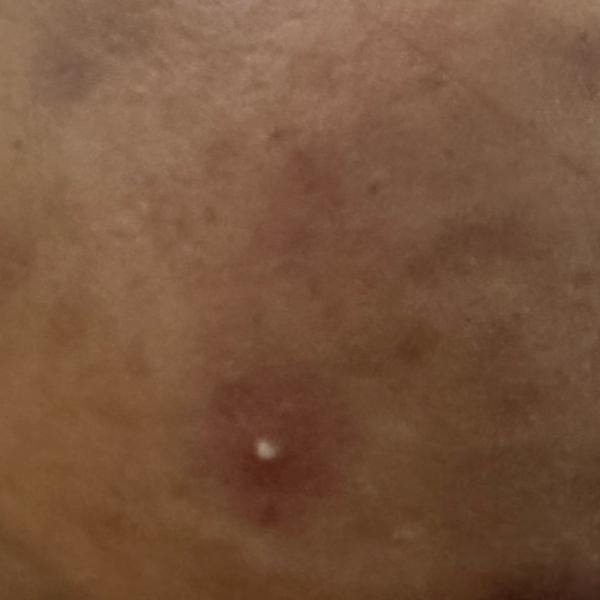 skin specialist near me