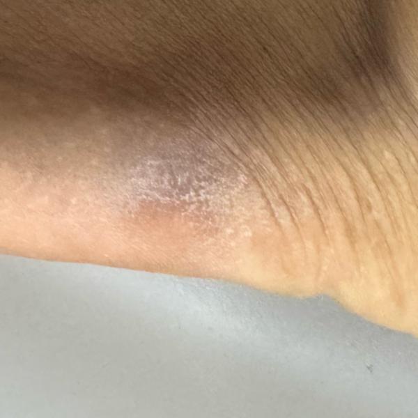 dermatology clinics near me in