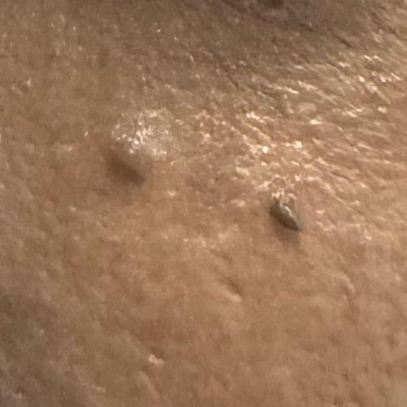 skin doctor near you in trichy