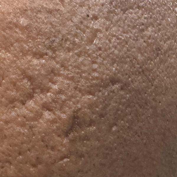 nearby dermatologist in trichy