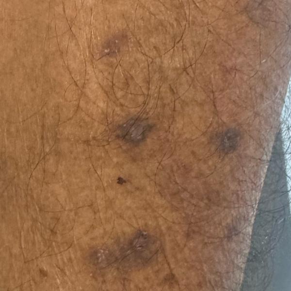 lady skin doctor near me