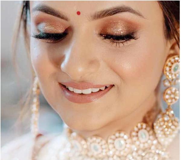 💍✨ Best Bridal Smile Makeover