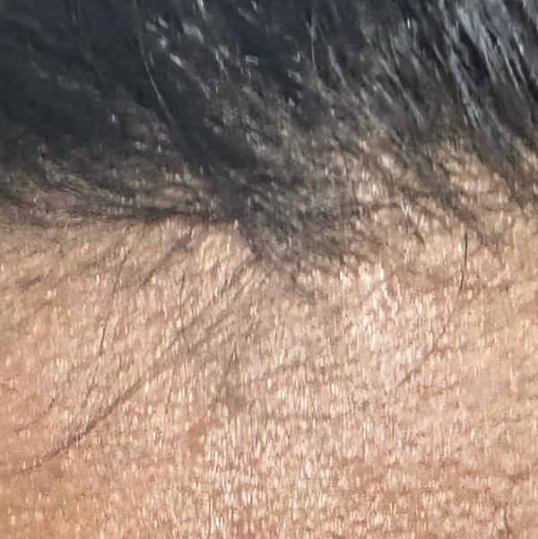 gfc treatment near trichy