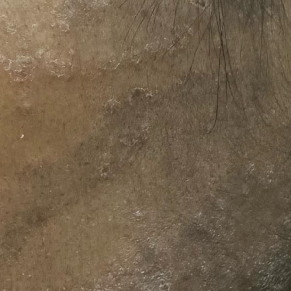 fungal infection doctor near m