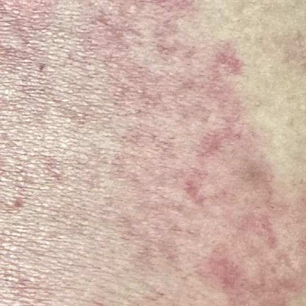 skin disease diagnosis and tre