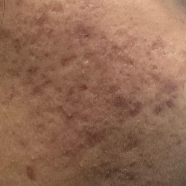 skin specialist near me