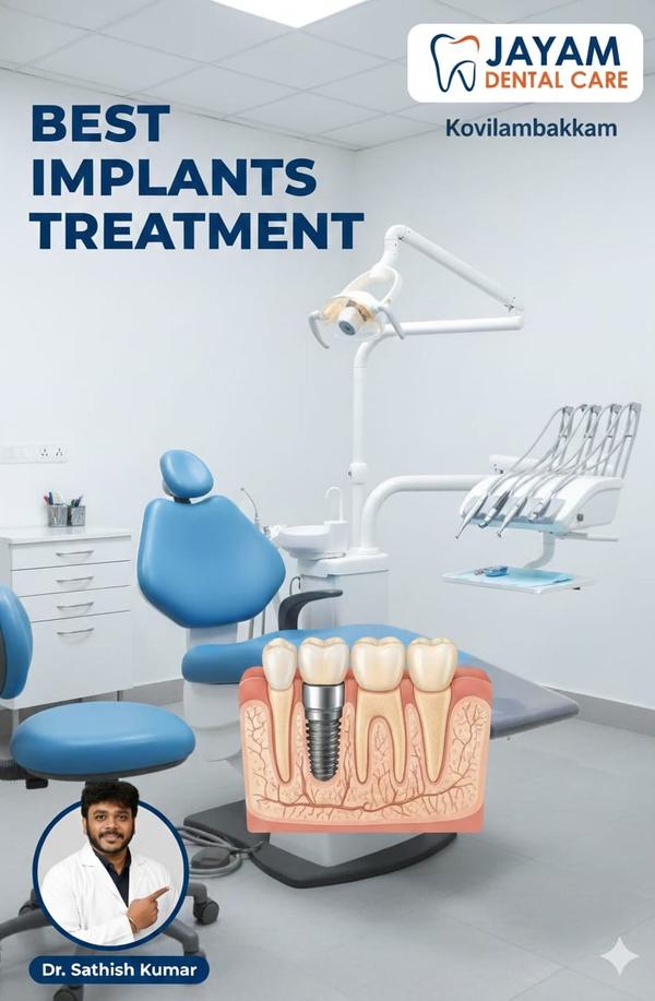 If you are looking for the bes