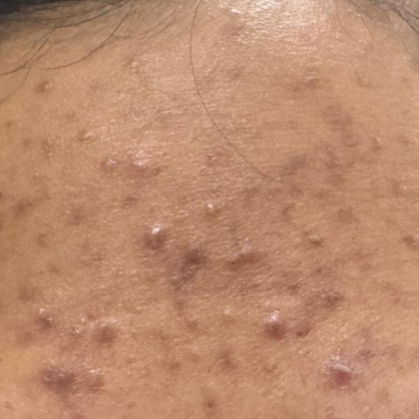 dermatology clinics near me in