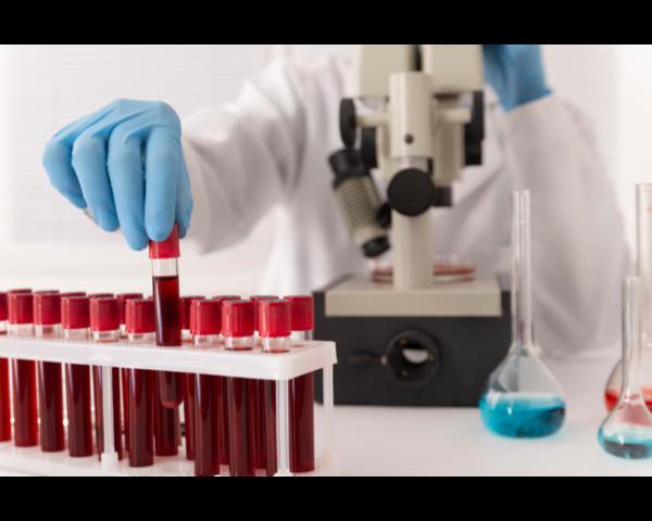 A dependable blood test lab he