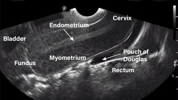 fertility assessment rohini de