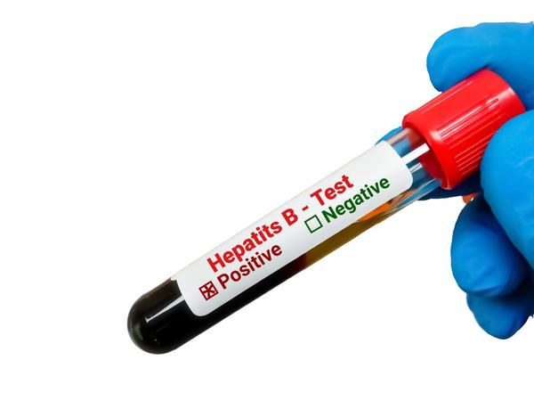 adenovirus igg antibody test d