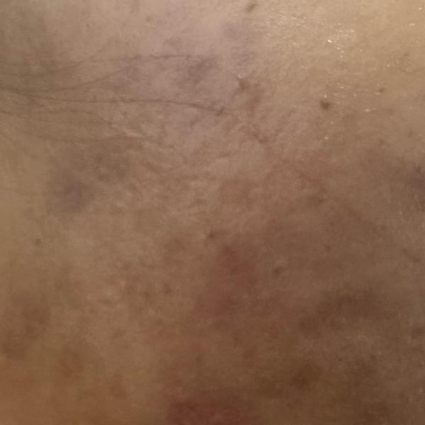 nearest dermatologist in trich