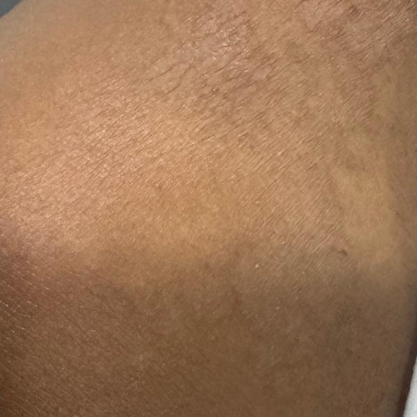 nearest skin doctor in trichy