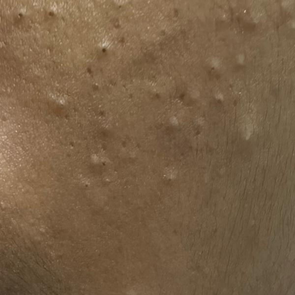 nearest skin doctor in trichy